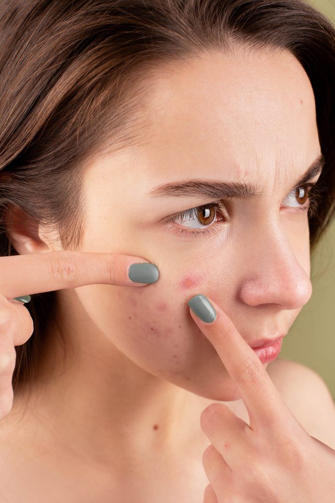  Acne: Understanding Types and Symptoms for Clearer Skin